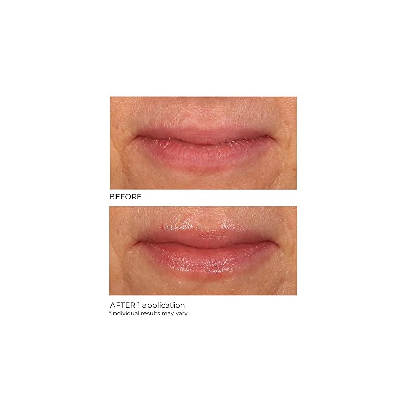 NASSIF MD Exfoliante Labial Nassifmd De Vainilla Y Azúcar, Hidratante