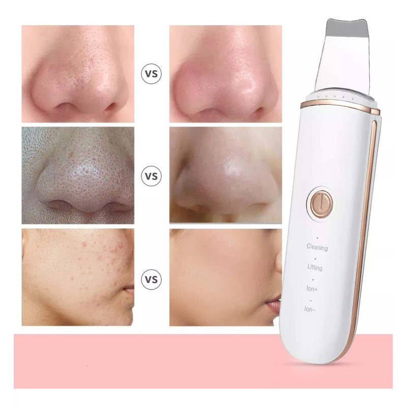 Monstyle Skin Scrubber, Ultrasónico Exfoliación Limpiador Cuidar Piel