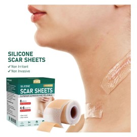 1.5m Parches De Silicona Para Eliminar Cicatrices Cesárea