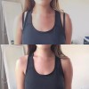 Razor Clips Bra Strap Clips Made in the USA Racer