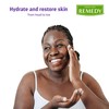Medline Remedy Essentials Moisturizing Body Lotion (4 oz Bottle), Unscented,