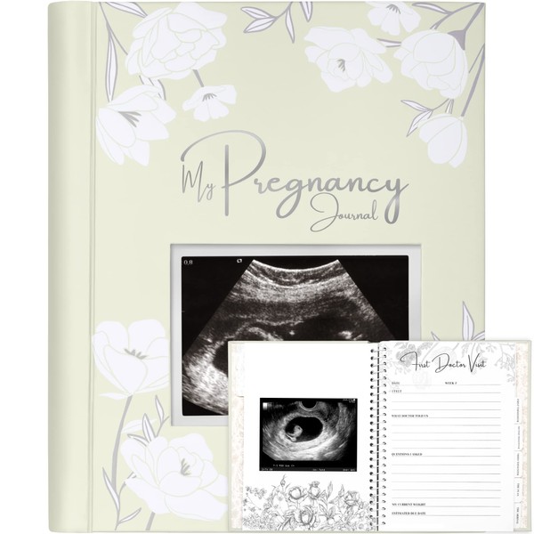 Pregnancy Journal, Pregnancy Announcements - 80 Pages Hard Cover Pregnancy Book For Mom To Be Gift - Pregnancy Gifts For New Moms - First Time Expecting Mom Gift - Baby Album And Memory Book (Chiffon)
