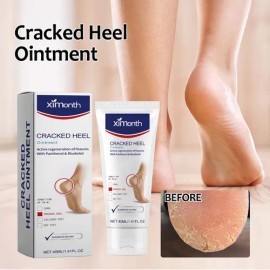 ! Crema De Urea Para Protección De Manos Y Pies En V Que .