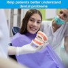 Diyiming 2Pcs Standard Teeth Model Dental Care Model, Child Brushing
