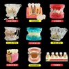 DentiForm 덴티폼 모형 위생사 재료상 모양 임플란트 기공사 입모형 [1