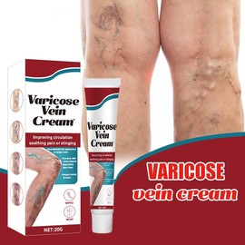 2PCS Varicose Veins treatment for legs,Anti Varicose Vein Soothing Leg Cream,Improves Blood Circulation, Reduces Varicose Veins and Heaviness Lymphatic Massage Cream 20G/0.70OZ