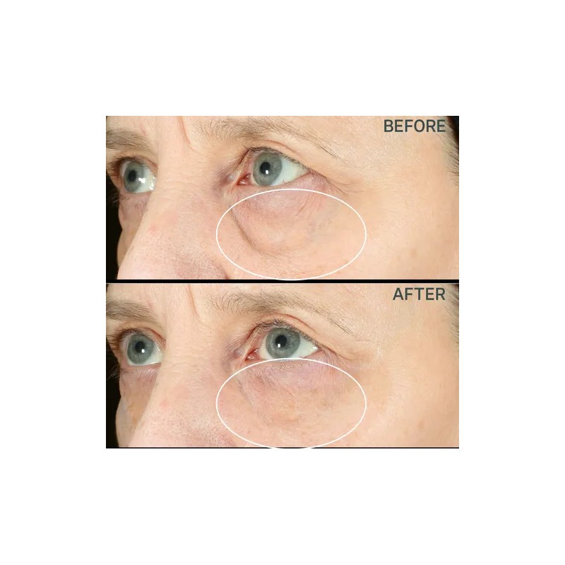 Strivectin Anti Wrinkle Sd Advanced Crema De Rostro Y Ojos