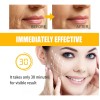 🔥 4×facial antiarrugas p/arrugas nasogenianas Vitaminas y Minerales