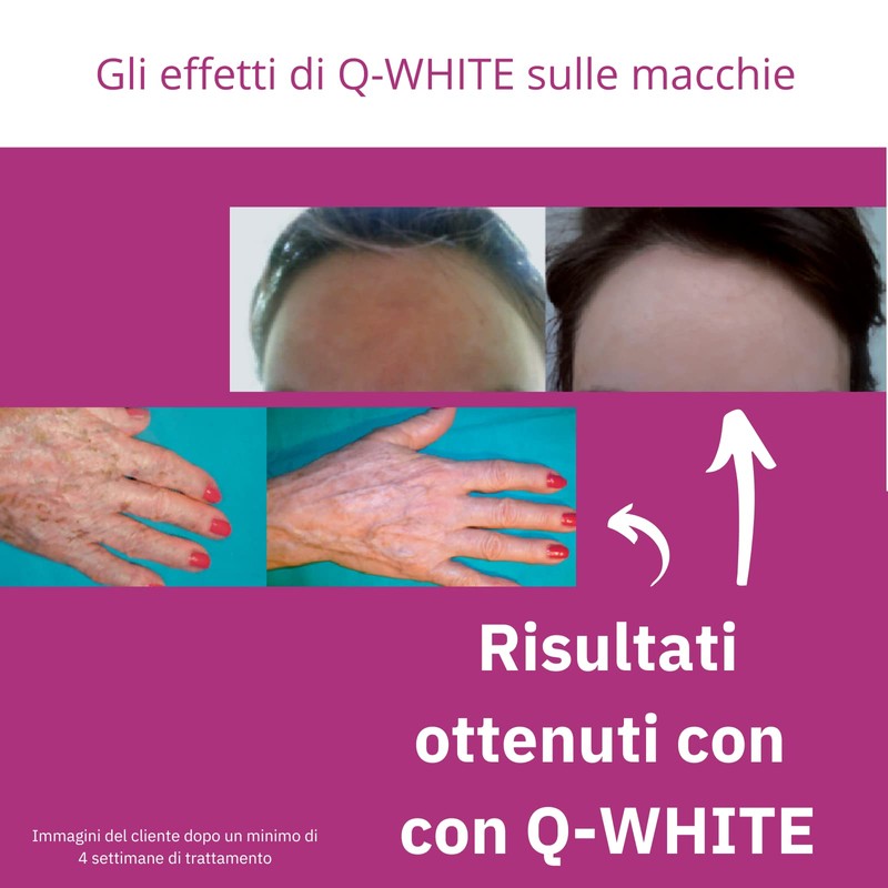 Q-WHITE lightening whitening cream gel for skin stains blemishes: hyperchromia,