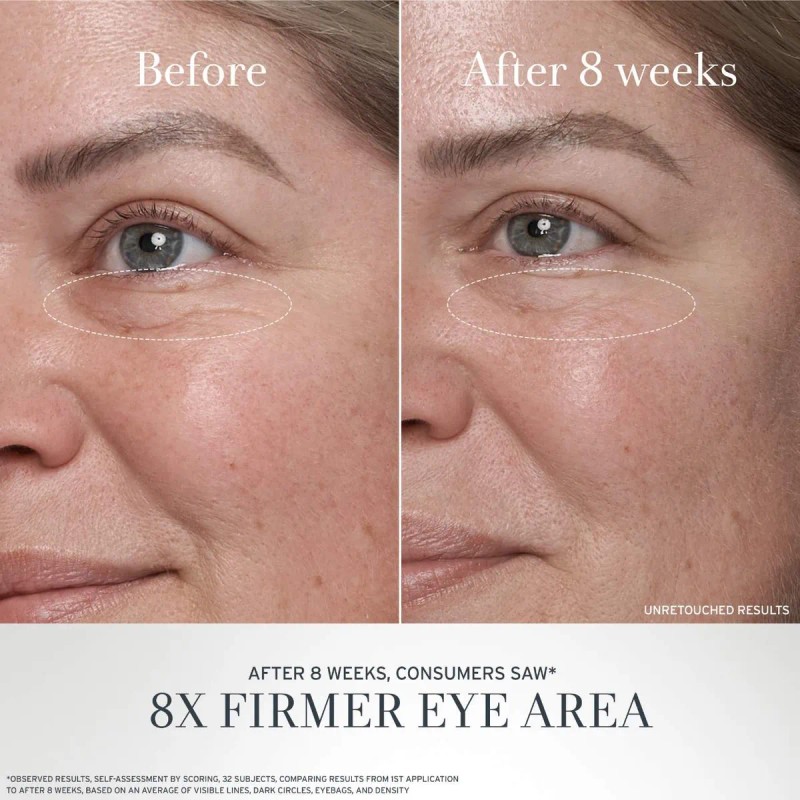 Fresh Black Tea Advanced Age Renewal Crema Ojos 15ml Todo
