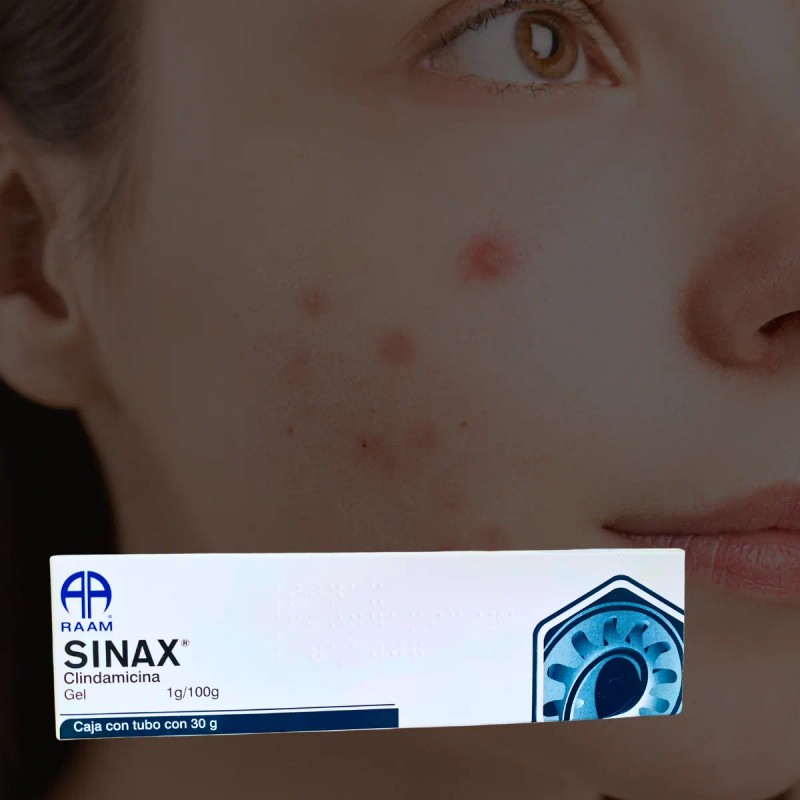 Sinax Clindamicina Gel 1g / 100g Tubo Con 30 G