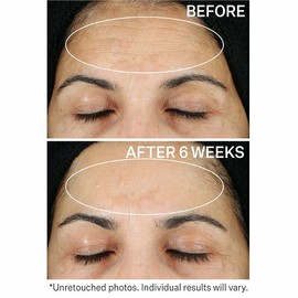 12M RETINOL MOISTURIZER DAY/NIGHT CREAM w/ Hyaluronic Acid - Highest Strength (2.5%)