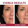 Loreal Paris Skincare Revitalift Triple Power Crema De Ojos