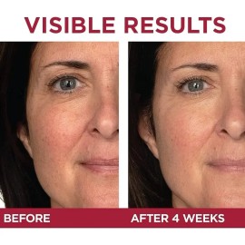 Loreal Paris Skincare Revitalift Triple Power Crema De Ojos                                                                                           