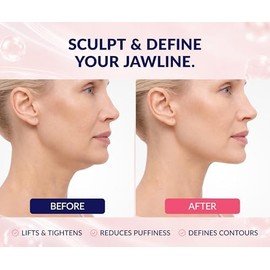 Stylia Mascarilla Doble Mentón - Correa Para La Mentón Línea V - Mascarilla Facial De Colágeno De Hidrogel Tonificante Con Ácido Hialurónico Y Aloe