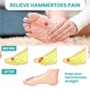 Welnove Hammer Toe Straightener Toe Corrector for Women - 8