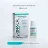 Tratamiento Localizado Skin-CR para Acné con Ácido Salicílico y Azufre