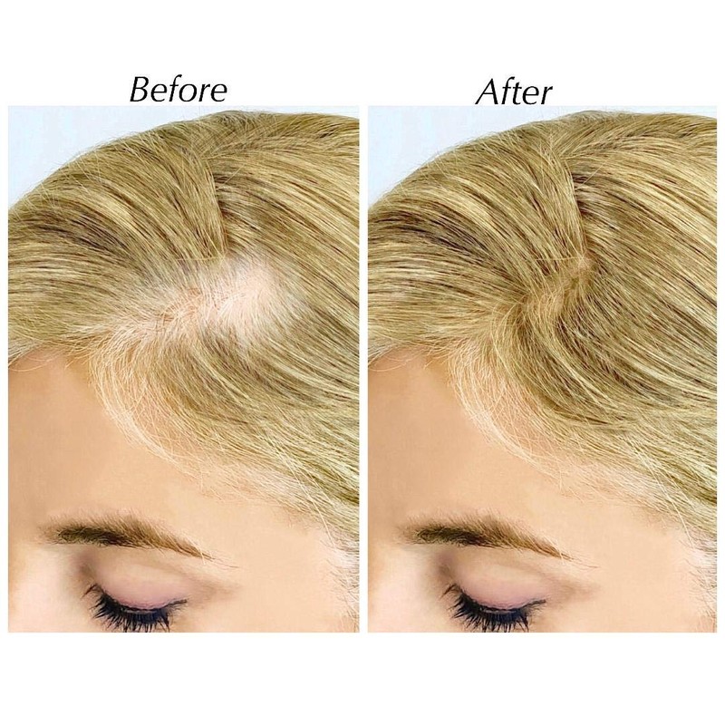SALON IN A BOTTLE Powder - Root Touch Up, Instantly