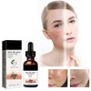 Sérum Facial Generic
