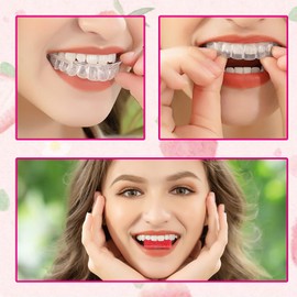 Aligner Chewies for Tray Seaters,Dental Teeth Chewies,5Pcs Chompers Aligner Trays(Mint,Orange,Grape,Lemon,Strawberry)