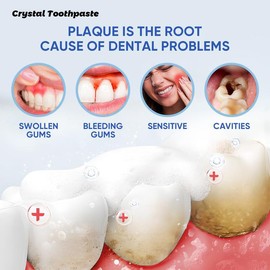 UTOGRU Probiotic Whitening Toothpaste with Nicotinamide Free of Fluoride for Oral Health Management Teeth Whitening Solution Daily 3-pack