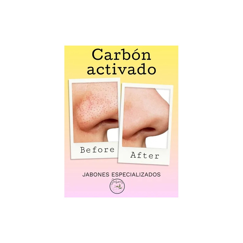 Jabon Carbón Activado
