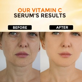 +1HEROLABS +1HEROLABS 2 Packs Vitamin C Serum for Face ?nti Aging Face & Eye Serum with Vitamin C, Hyaluronic Acid, Vitamin C Face Serum for Women/Men, Reduce Fine Lines, Dark Spots and Wrinkle