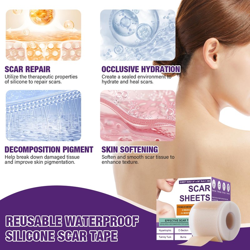 Silicone Scar Sheets,Silicone Scar Tape,Silicone Scar Removal Strips for Surgical,C-Section,Tummy