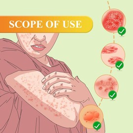 South Moon Bee Venom Psoriasis Cream,   Skin  Hand Moss Moisturizing Skin Care Cream:_2pcs_default