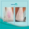 Jabón Dermabon Individual De 90 Gramos