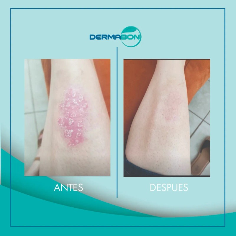 Jabón Dermabon Individual De 90 Gramos