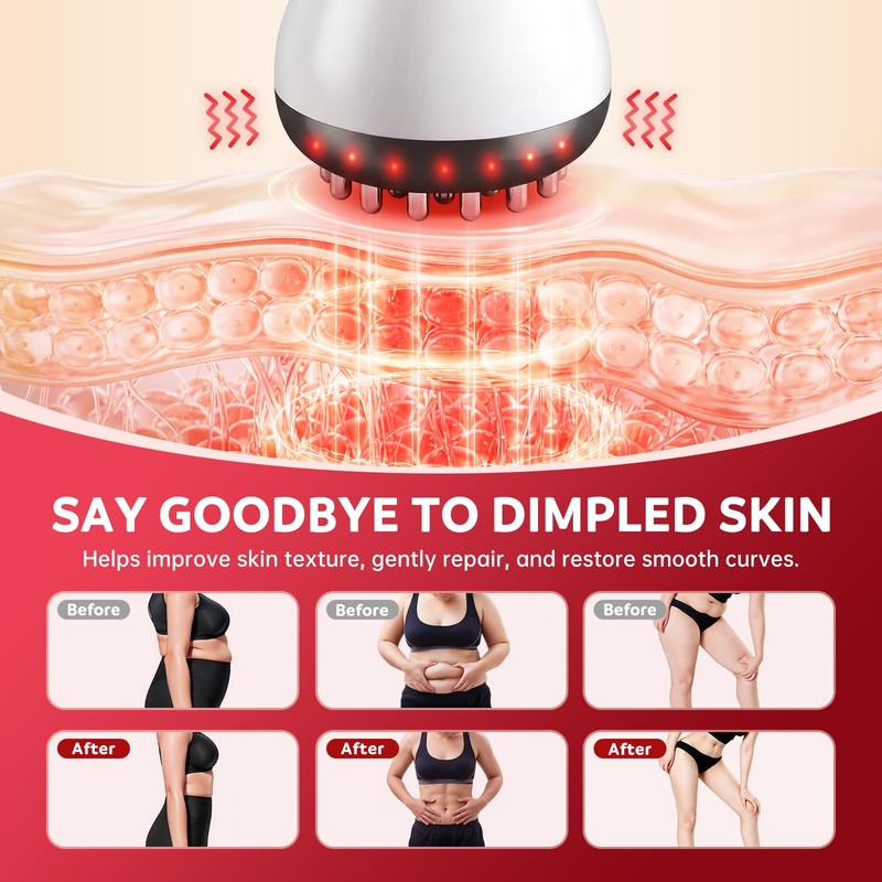 Yincook Lymphatic Drainage Massager & Anti Cellulite Massage Tool