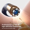 bebird Smart Visual Ear Cleaner, 1 Box Waterproof Ear Wax