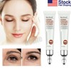 3x Crema para los ojos Bolsas para quitar instantáneamente Ojeras