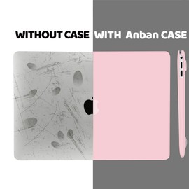 Anban Compatible with MacBook Pro 13 inch Case 2025 2024 2023 M2, 2022-2016 M1 A2338 A2251 A2289 A2159 A1989 A1708 A1706, Plastic Laptop Hard Shell Case +Keyboard Cover +Screen Protector, Baby Pink