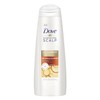 Dove Dermacare Scalp - Anti-Dandruff Shampoo - Dryness & Itch