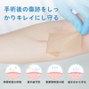 URAY 【Recommended by Beauty Dermatologists】Caesarean Section Wound Tape Keloid Tape