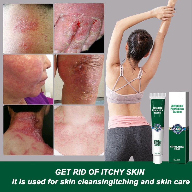 2pcs Hydrating Moisturizing Cream Eczema Erythema Repair Cream Itchy Skin