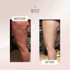 FasciaBlaster The ProBlaster Handheld by Ashley Black. Scientifcally Proven MyoFascial