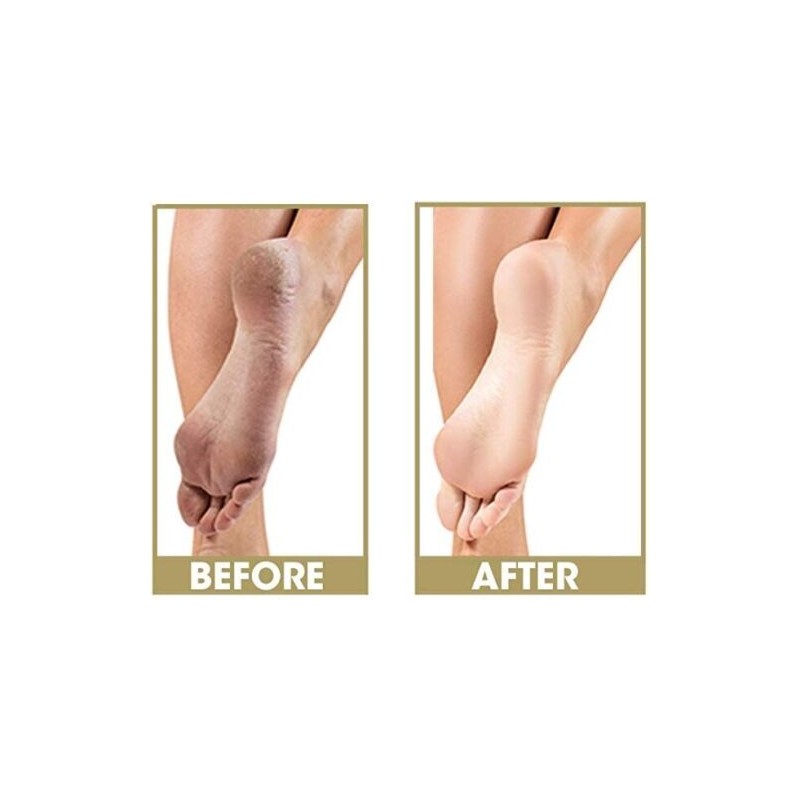 Prolinc Be Natural Cuticle Eliminator + Callus Eliminator 4oz Duo