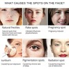 Crema para Manchas Oscuras en La Cara, Cremas para Quitar