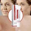 Crema Despigmentante Anti Manchas Zoo·son 20g