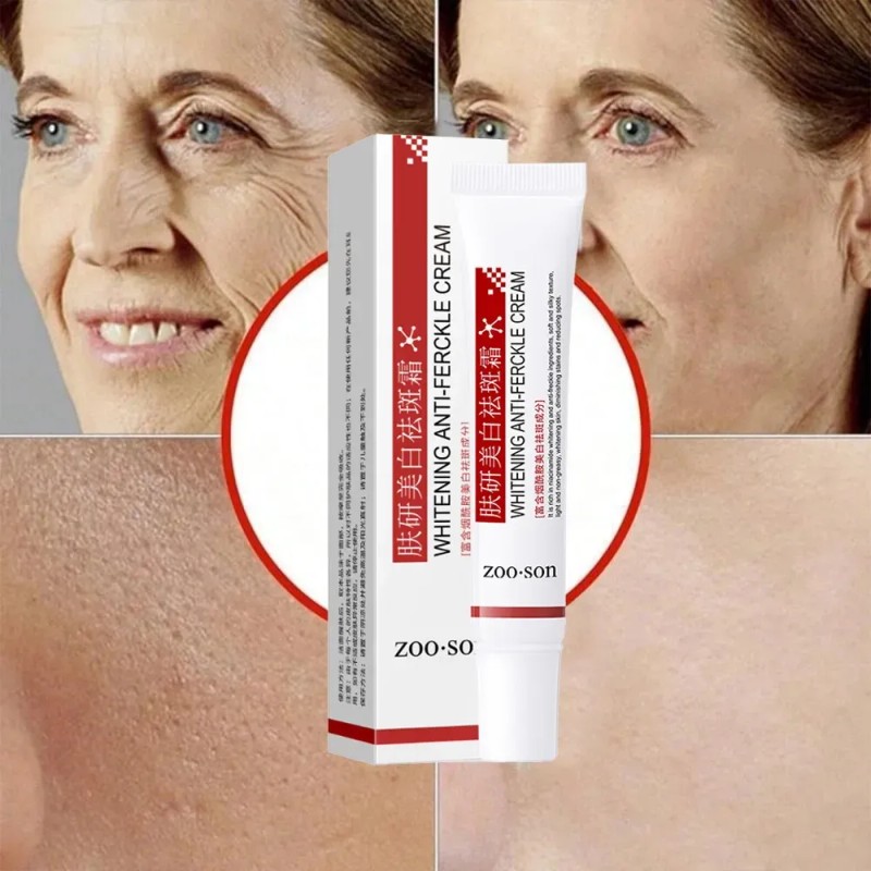 Crema Despigmentante Anti Manchas Zoo·son 20g