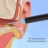 Ear Wax Removal Tool, 360 Degree View Ear Cleaner with
