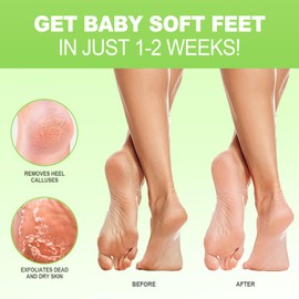 Foot Peel Mask 3 Pairs - Exfoliating Peeling Callus Remover, Repairs Cracked Heels & Dead Dry Skin, for Smooth & Soft Feet, Aloe Vera