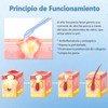 Alta Frecuencia Facial, Radiofrecuencia Facial y Corporal con 4 Varitas