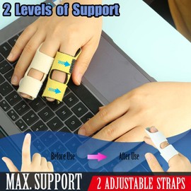 Kecartu 6 Pack Trigger Finger Splint, Finger Support Brace with Adjustable Fixing Belt for Straightening, Sprained, Tendinitis, Broken Finger Fits Index Finger,Middle Finger, Ring Finger (2 Straps)