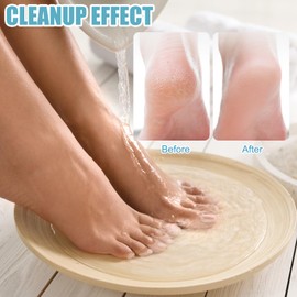 FEXPDL Feet Scrubber Dead Skin 4 in 1 Foot Scrubber, Cleaning Foot Pumice Stone for Feet Foot Stone, with Stainless Steel Fine File and Foot Scrubber for Both Dry and Wet Feet Foot Care