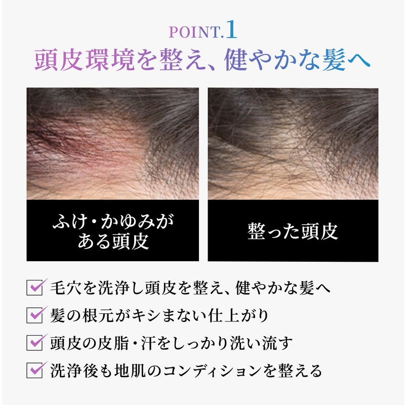 Rhodomis Sparkling Shampoo, Dense Bubbles of Excitement (Carbonated Head Spa