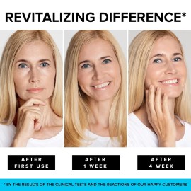 SimplyVital Nourishing Retinol Face Moisturizer With Hyaluronic Acid 1.7 Fl Oz Anti Aging...